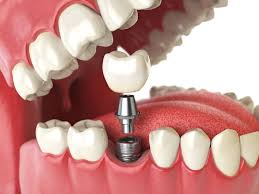 Dr. Lisa & Dr. Tisa's Dental House Vaikom